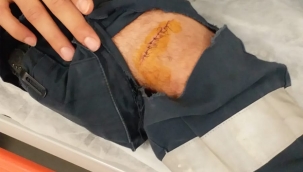 Hastanede makasla görev başındaki sağlık çalışanını yaraladı