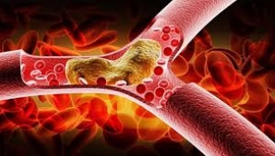 Kan Yağları Neden Yükselir? Nelere Dikkat Etmeliyiz? 