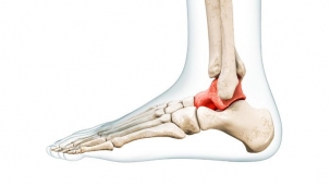 Talus kemiği nedir? Talus kemiği neden ağrır, neden şişer?