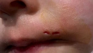 İzmir'de AVM'deki sahipsiz köpek 3 yaşındaki Elif'e saldırdı